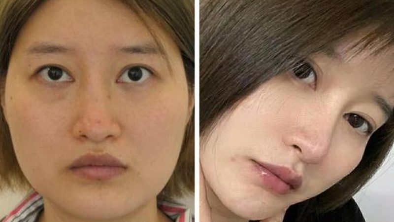 在成都，医美机构众多，如何挑选一家好的机构呢？以下是一些关键因素：
