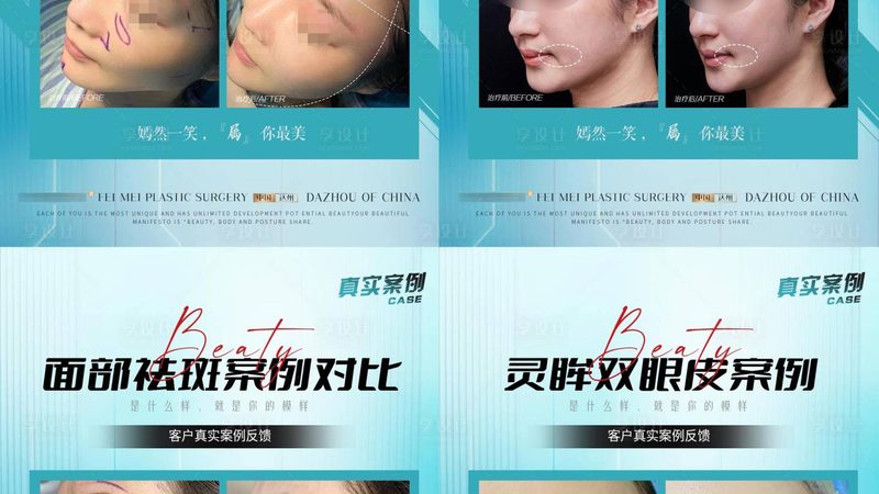 抗衰激光超声刀，定制方案如何打造？**