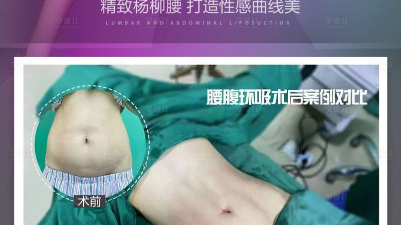 面部提升手术：揭秘风险与后遗症**