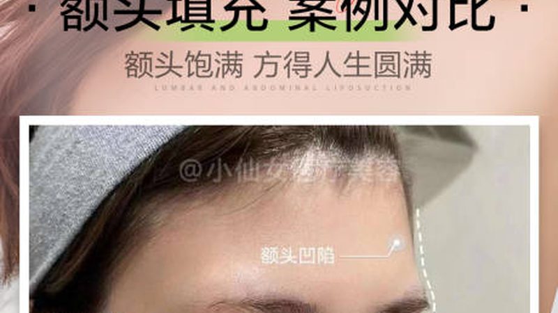 微整形与手术整形：不同需求，不同选择