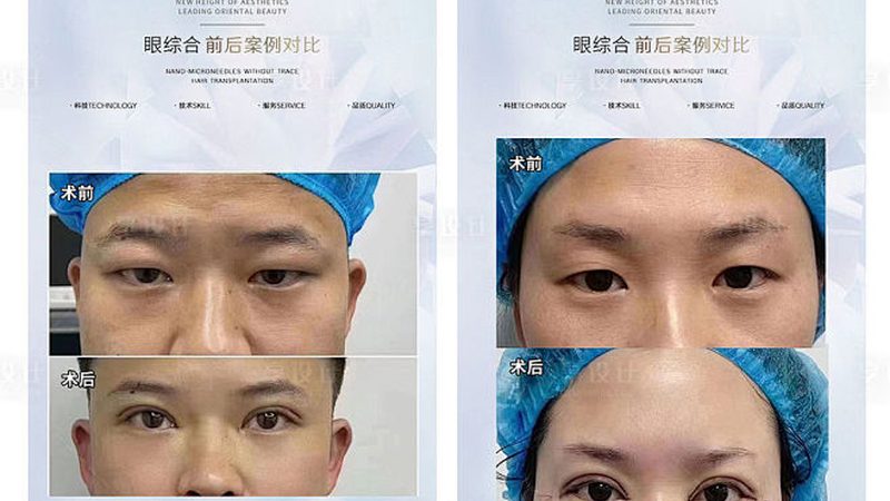 北京注射美容术后护理流程