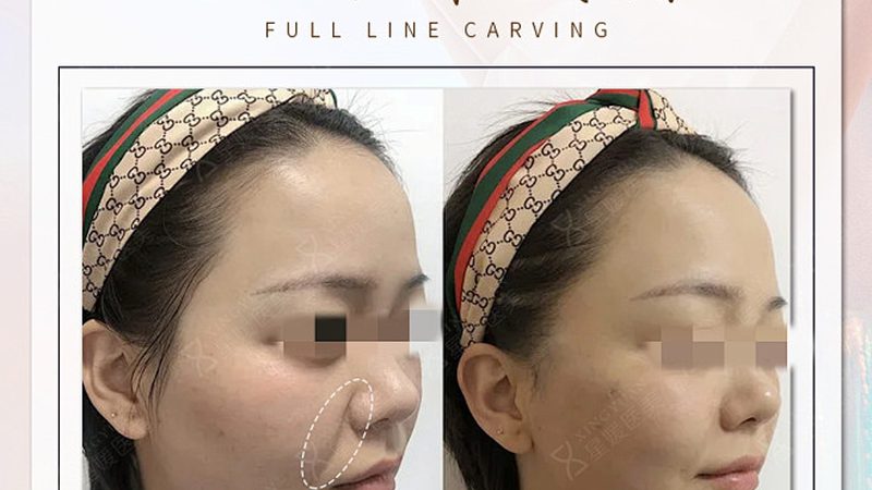 激光美容加盟，揭秘费用背后的秘密
