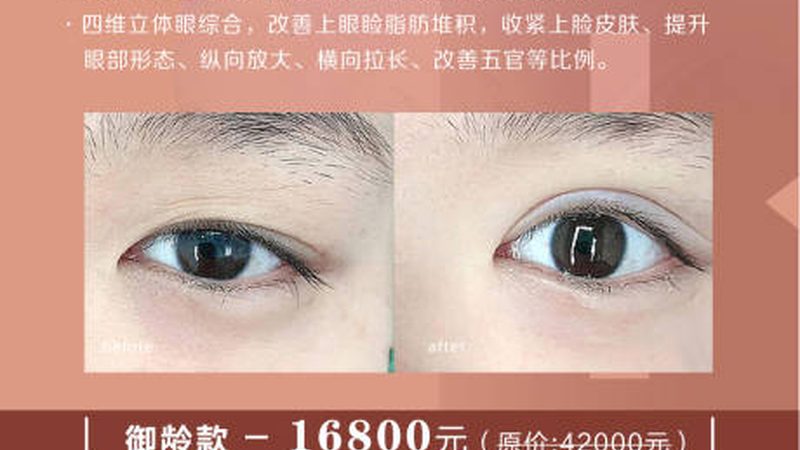 激光抗衰与超声刀：揭秘两者作用原理的差异