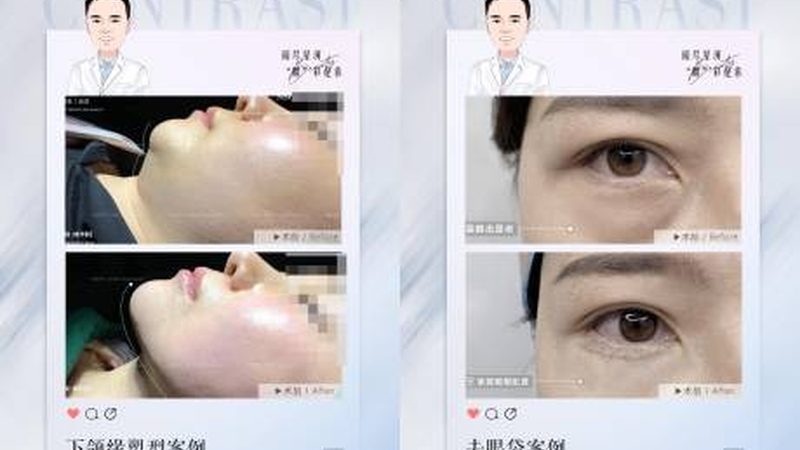 刷酸后，你的皮肤护理该这样做