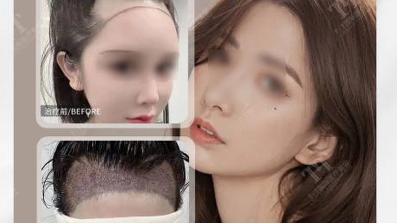 轻医美培训学校学费能退吗？揭秘退费那些事儿