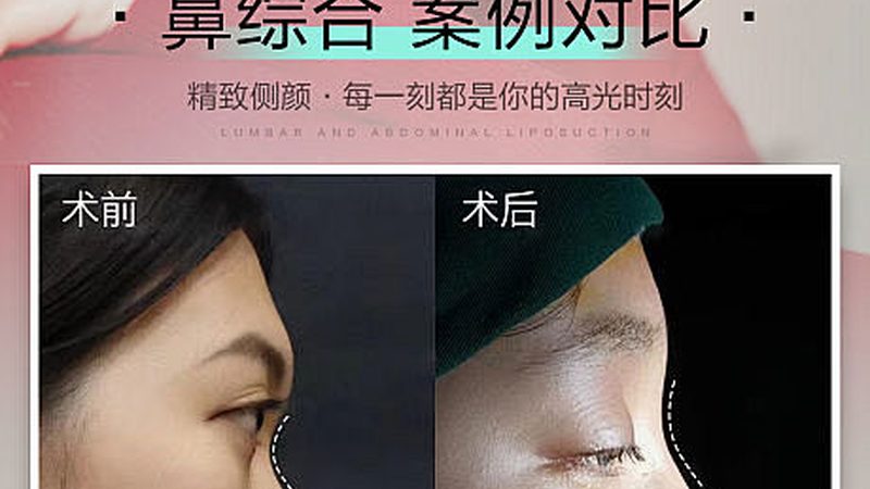 医美咨询师报价表，揭秘行业“标价”背后的秘密