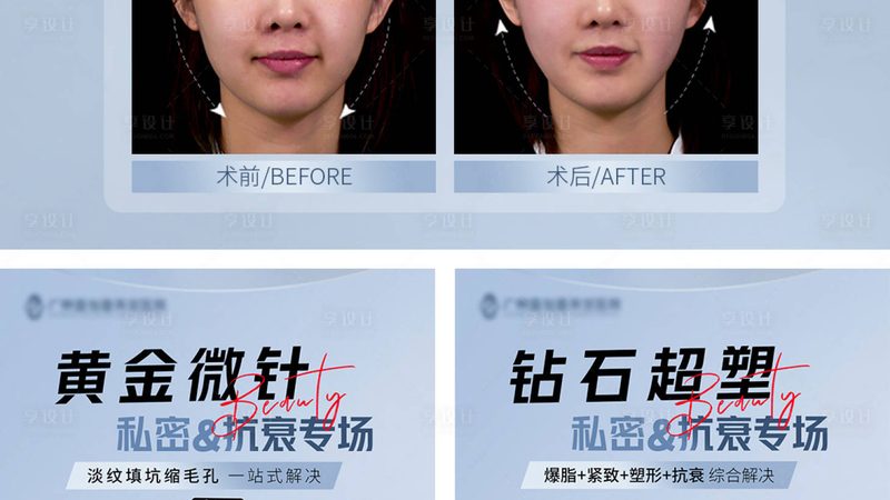 成都超声炮医院价格差异解析