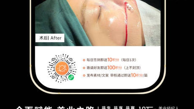 激光美容仪器生产厂家哪家好