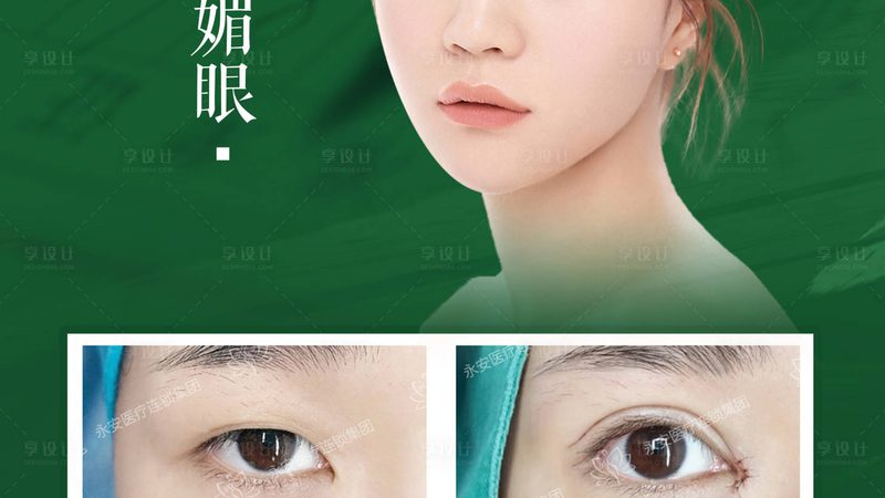 肉毒素除皱，如何辨别上海正规医院？**