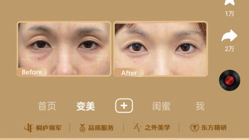 轻医美产品批发，揭秘高效流程步骤